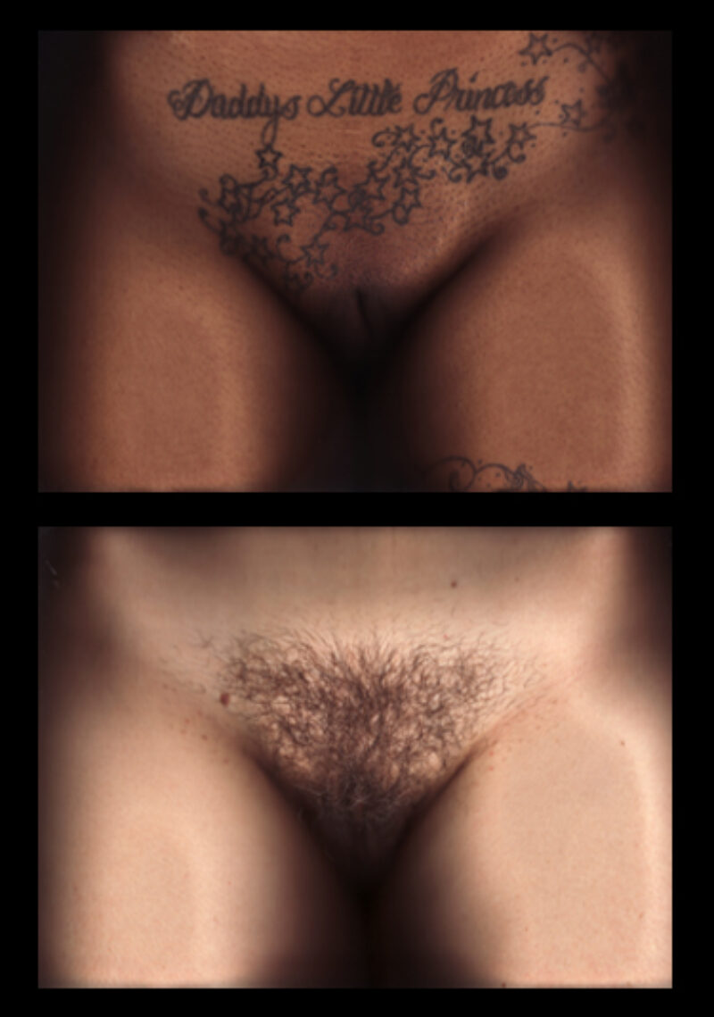 scanner photography images of pubic hair and tattoos