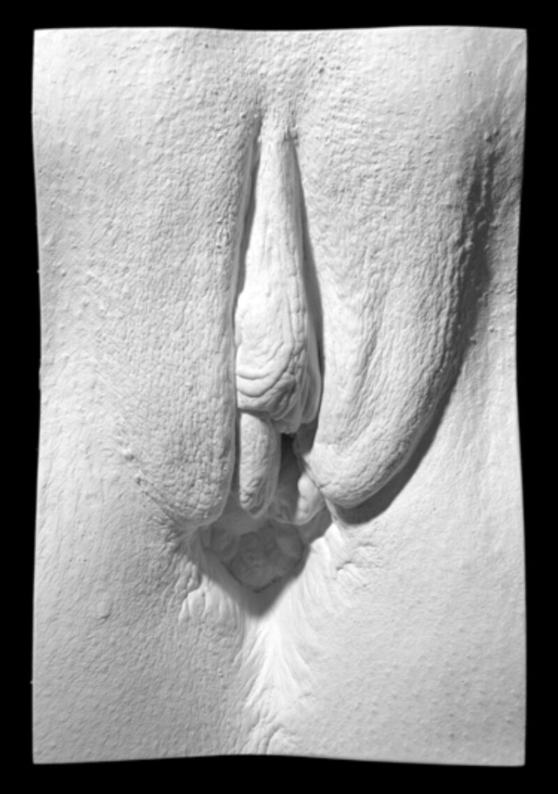 plaster cast of a vulva from The Great Wall of Vagina following partial vulvectomy surgery