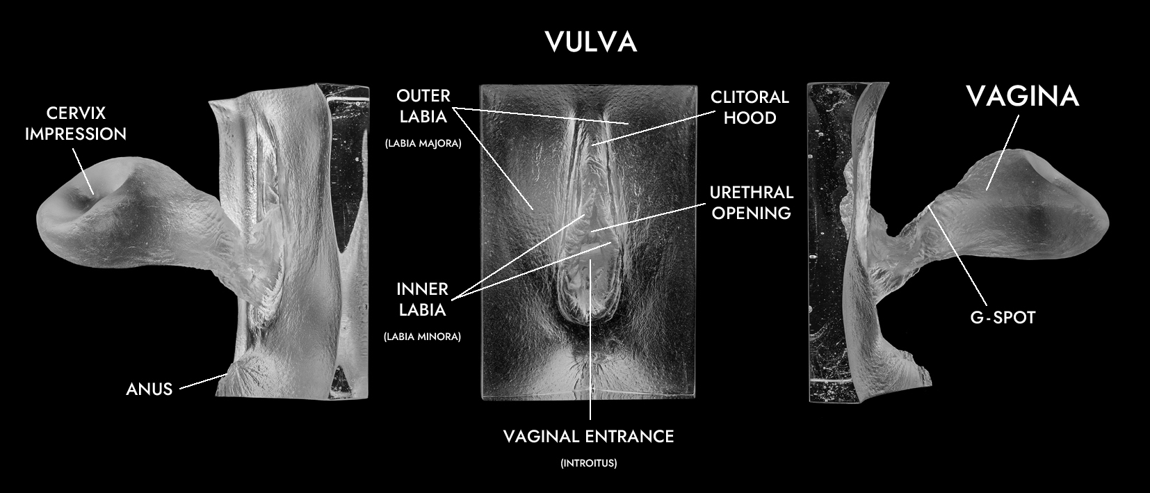 glass internal vagina cast from various angles with anatomical annotations 