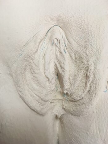 spread vagina in plaster