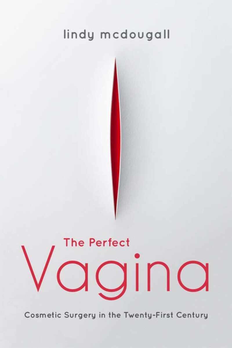 The Perfect Vagina Cosmetic Surgery in the Twenty-First Century by Lindy McDougall